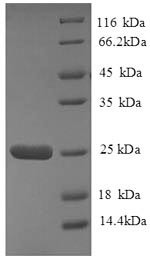 HLA class II histocompatibility antigen, DQ alpha 2 chain (HLA-DQA2),partial, human, recombinant