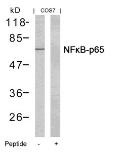 Anti-RELA (Ab-435)