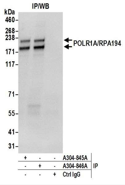 Anti-POLR1A/RPA194