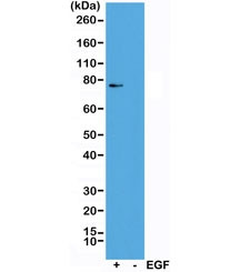 Anti-phospho-RSK1 (Thr359/Ser363), clone RM233 (recombinant antibody)