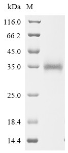 Spike glycoprotein (S), partial, Severe acute respiratory syndrome coronavirus, recombinant