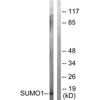 Anti-SUMO1