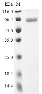 N-myc proto-oncogene protein (MYCN), human, recombinant