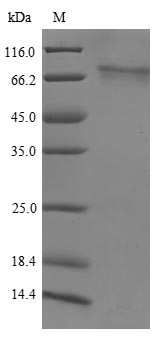 Histone-lysine N-methyltransferase NSD3 (NSD3), human, recombinant