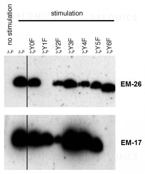 Anti-phospho-CD3 zeta (Tyr72) Monoclonal Antibody (Clone:EM-26)