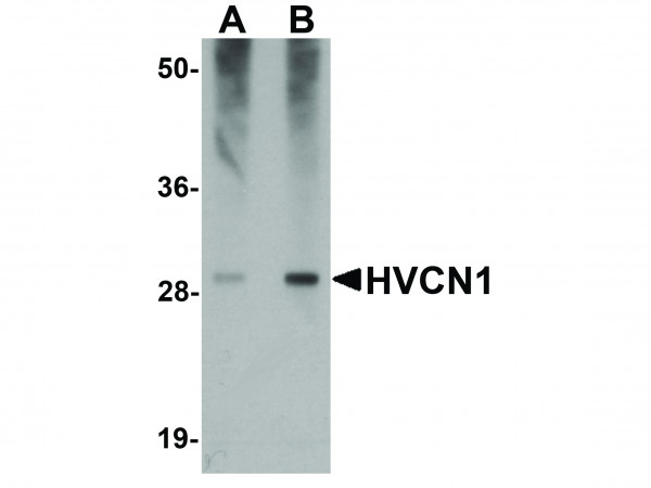 Anti-HVCN1