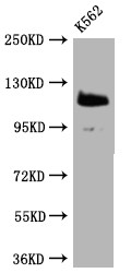 Anti-PARP1 Recombinant Monoclonal, clone 7C11