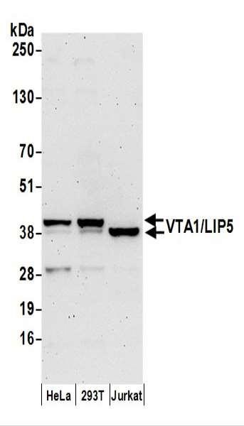 Anti-VTA1/LIP5