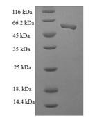 Casein kinase II subunit alpha&#039; (CSNK2A2), partial, human, recombinant