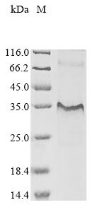 Interleukin-7 receptor subunit alpha (IL7R), partial, human, recombinant