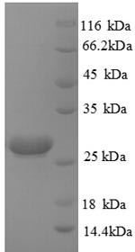 Hypoxanthine-guanine phosphoribosyltransferase (HPRT1), human, recombinant