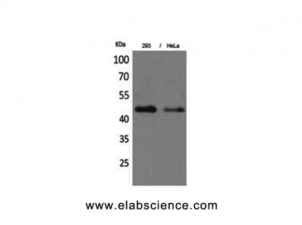 Anti-IDH1