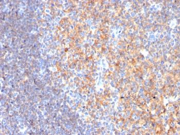 Anti-CD19 / B-lymphocyte marker, clone CD19/3116