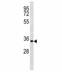 Anti-Cyclin D2 (CCND2)