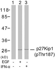 Anti-Phospho-CDKN1B (Thr187)