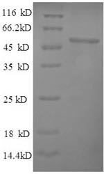 Pyruvate carboxylase 1 (PYC1), partial, Saccharomyces cerevisiae, recombinant