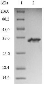 Ryanodine receptor 3 (RYR3), partial, human, recombinant