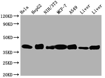 Anti-ALDOA Recombinant Monoclonal, clone 7D8