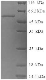 Tyrosinase (TYR), partial, human, recombinant