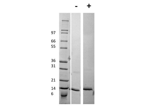 Procalcitonin