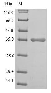 L-lactate dehydrogenase A chain (LDHA), partial, human, recombinant