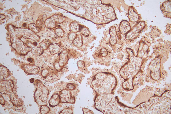 Anti-HSD3B1 Recombinant Monoclonal, clone 10G2