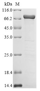 Histone H1.3 (HIST1H1D), human, recombinant