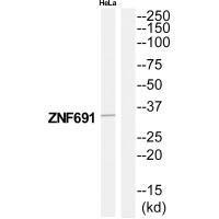 Anti-ZNF691