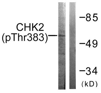 Anti-Phospho-CHEK2 (Thr383)