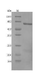 Aldehyde dehydrogenase family 1 member A3 (ALDH1A3), human, recombinant