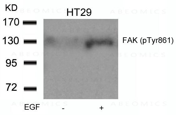 Anti-phospho-FAK (Tyr861)