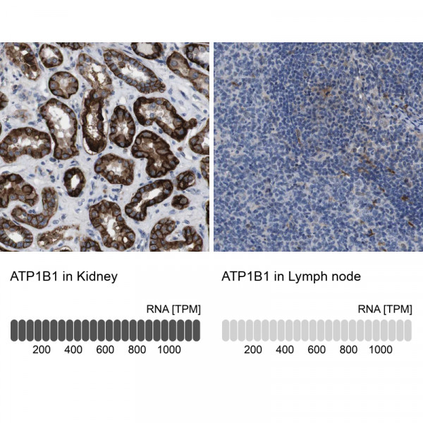 Anti-ATP1B1