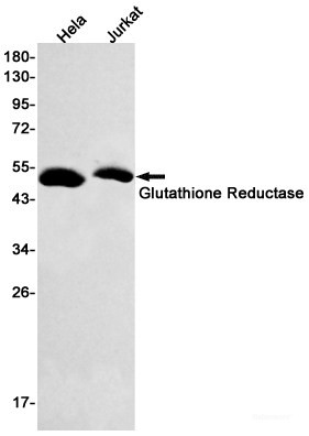 Anti-Recombinant Glutathione Reductase, clone R08-2E4