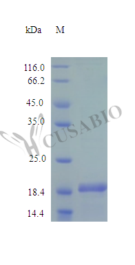 Sonic hedgehog protein (SHH), partial (Active), human, recombinant