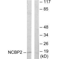 Anti-NCBP2