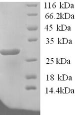 Potassium-transporting ATPase subunit beta (ATP4B), partial, human, recombinant