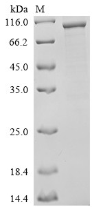 DNA polymerase theta (POLQ), partial, human, recombinant