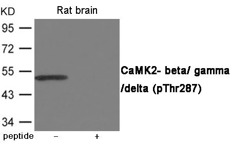 Anti-Phospho-CAMK2B/CAMK2G/CAMK2D (Thr287)