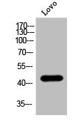 Anti-Phospho-OPRM1 (S375)