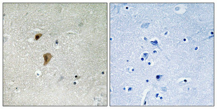 Anti-Phospho-HSF1 (Thr142)