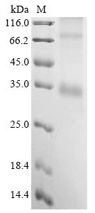 Melanocortin receptor 4 (Mc4r), mouse, recombinant