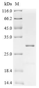 Membrane-associated progesterone receptor component 2 (PGRMC2), Partial, human, recombinant