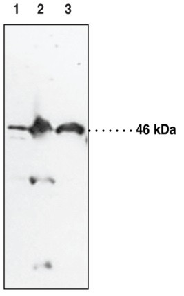 Anti-NAPE PLD