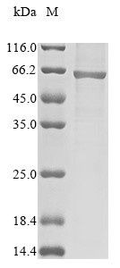 Glutamate receptor ionotropic, NMDA 1 (GRIN1),partial, human, recombinant