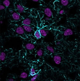 Anti-GFAP / Glial Fibrillary Acidic Protein, clone ASTRO/1974R