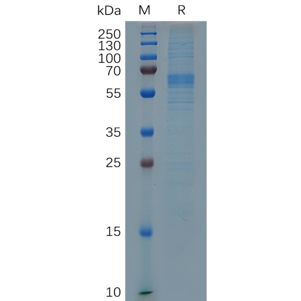 Mouse MFGE8 Protein, His Tag