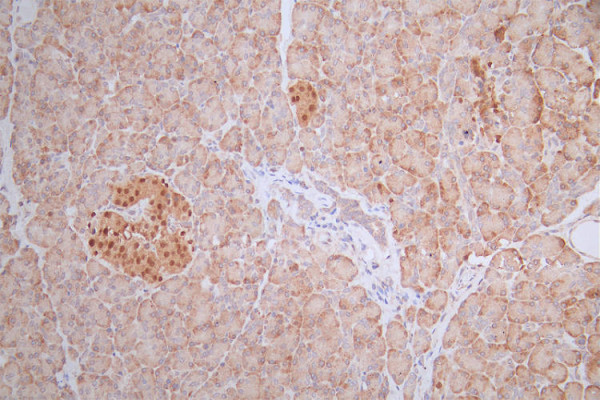 Anti-PAX6 Recombinant Monoclonal, clone 22C3