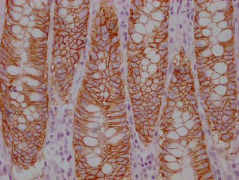 Anti-EPCAM Monoclonal