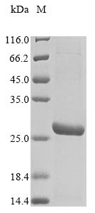 Transcriptional enhancer factor TEF-3 (Tead4), partial, mouse, recombinant