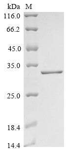 Oxysterols receptor LXR-beta (NR1H2), partial, human, recombinant